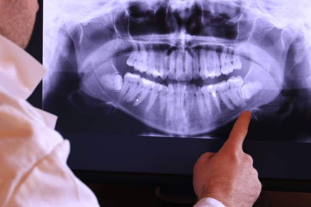 Best Emergency Broken Tooth Repair in Good Hope, CA