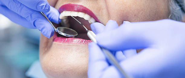 Best Emergency Root Canal Treatment in Good Hope, CA